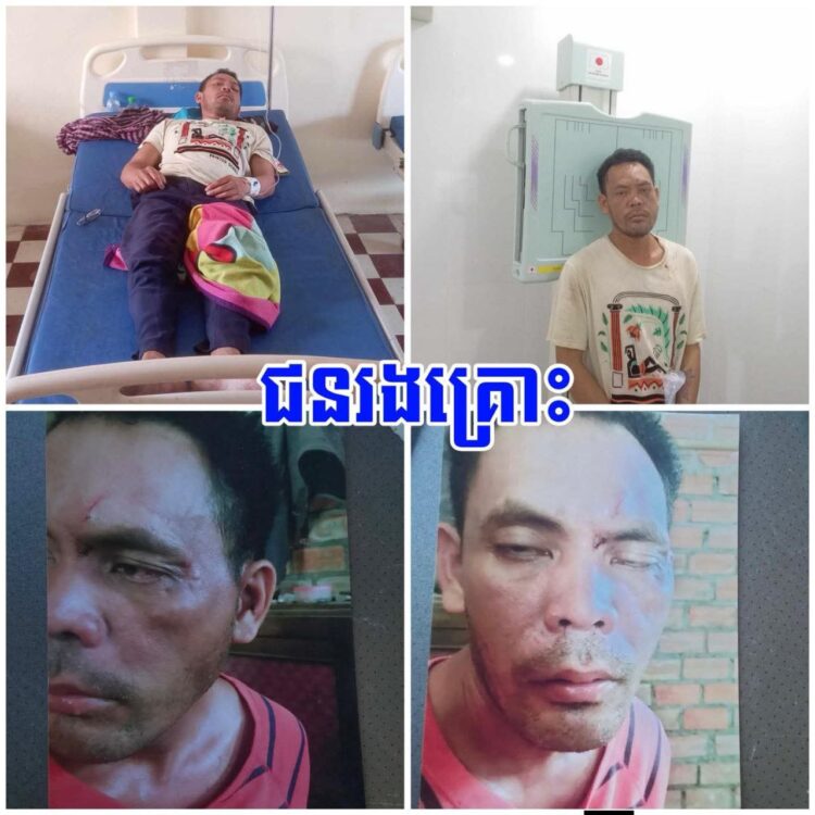 ស្នងការខេត្តកំពង់ឆ្នាំង សម្រេចផ្អាក តួនាទីនាយប៉ុស្តិ៍នគរបាលរដ្ឋបាល ស្តីទី ស្រុករលាប្អៀរ ករណីប្រើអំពើហិង្សាលើប្រជាពលរដ្ឋ