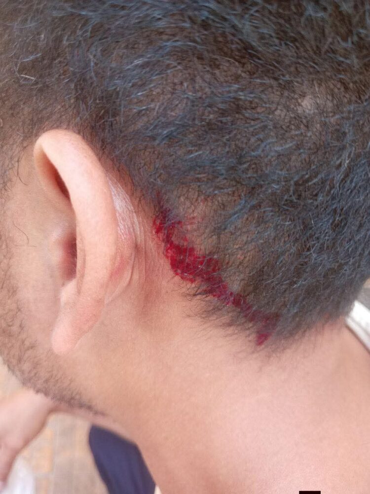 ស្នងការខេត្តកំពង់ឆ្នាំង សម្រេចផ្អាក តួនាទីនាយប៉ុស្តិ៍នគរបាលរដ្ឋបាល ស្តីទី ស្រុករលាប្អៀរ ករណីប្រើអំពើហិង្សាលើប្រជាពលរដ្ឋ